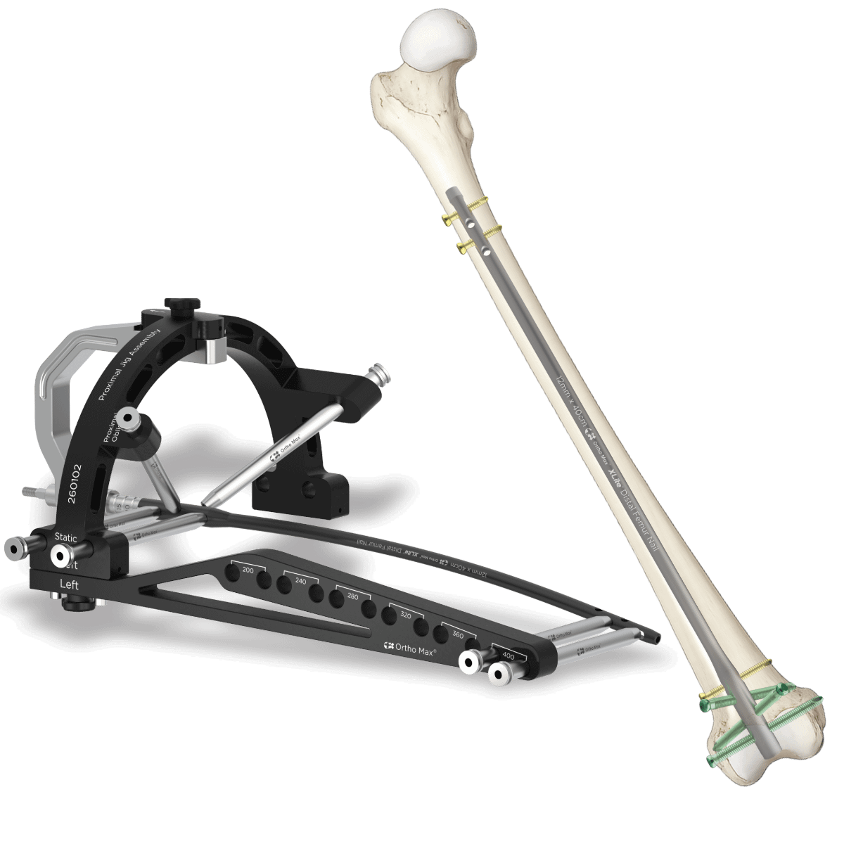 Xlite Interlocking Multiangle Nailing system