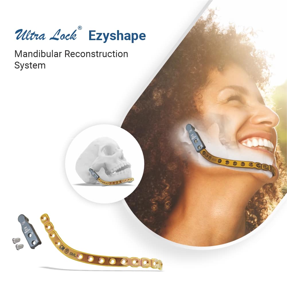 ultra lock ezyshape mandible reconstructions system by ortho max