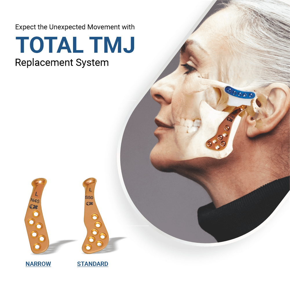 Ortho Max temporomandibular joint prosthesis and mandibular reconstruction system