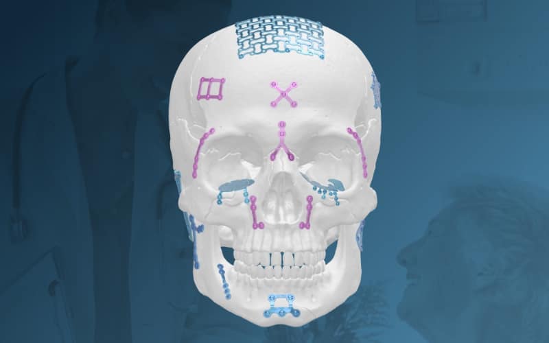 Cranio-Maxillofacial-CMFSystems.png