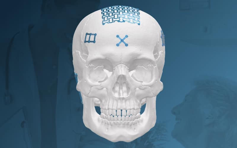 Neuro-Solutions-System.png