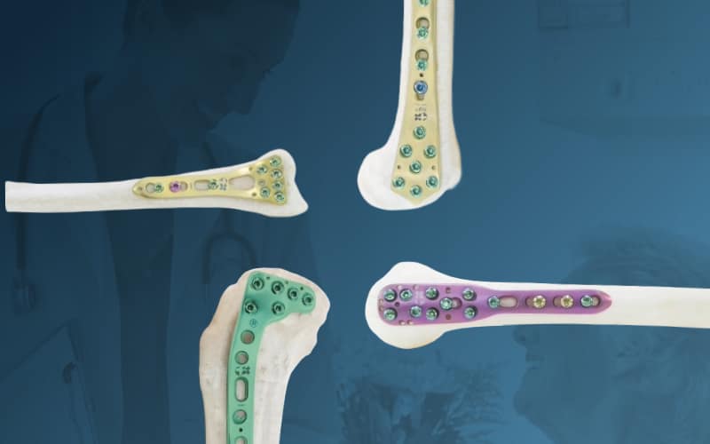Orthopaedic-Implants-System.png